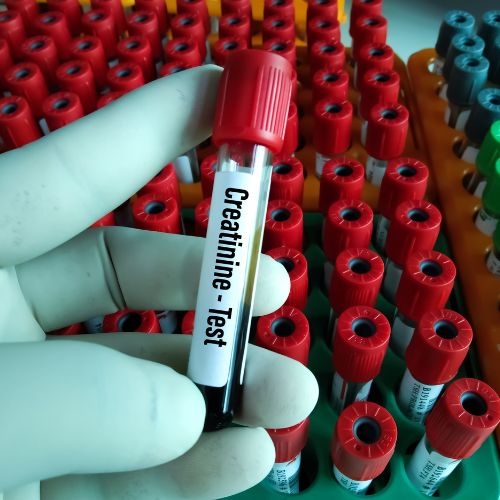 CREATININE