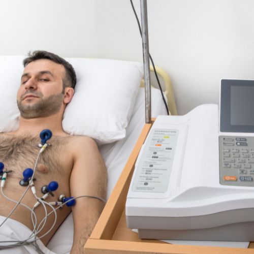 ECG
