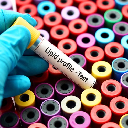 LIPID PROFILE