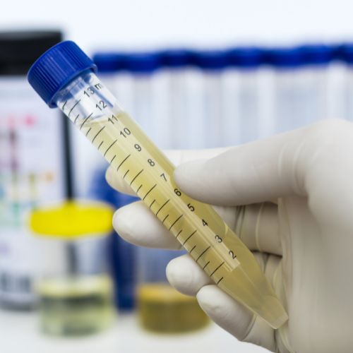 URINE ROUTINE