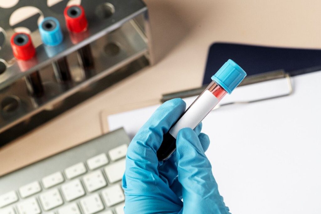 Blood Test Lab in Mangalore offering accurate diagnostic testing and reliable health screening services.