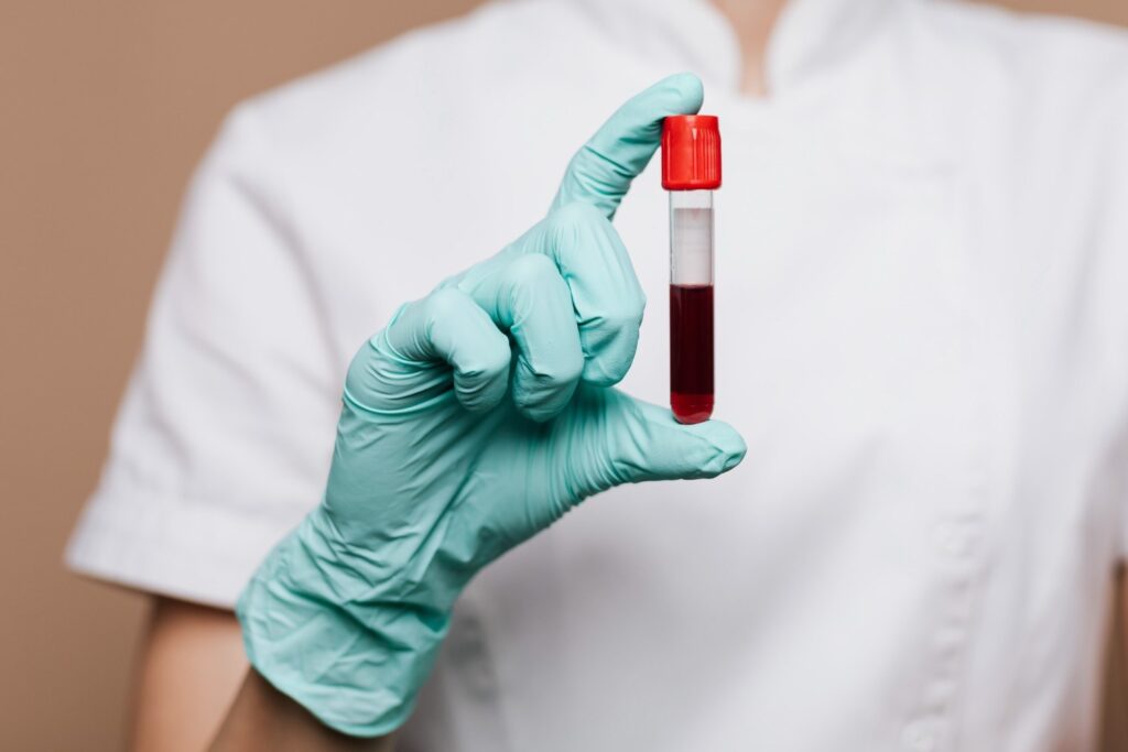 Accurate Blood Testing Services in Mangalore